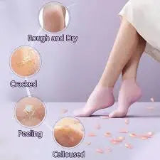 "Anti-Cracking Moisturizing Gel Socks – The Secret to Soft, Beautiful Feet!" paktronic.store